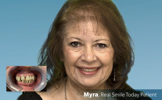 Banner-images-no-typePatient-Testimonials-Myra