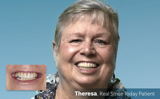 Banner-images-no-typePatient-Testimonials-Theresa