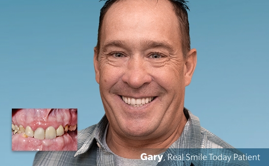 Patient-Testimonials-8